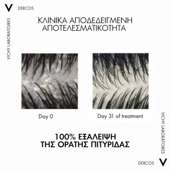 Vichy Dercos Anti Dandruff DS 2in1 Σαμπουάν κατά της Πιτυρίδας για Ξηρά Μαλλιά 390ml Vichy Dercos Anti Dandruff DS 2in1 Σαμπουάν κατά της Πιτυρίδας για Ξηρά Μαλλιά 390ml