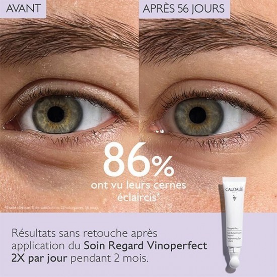 Caudalie Vinoperfect Κρέμα Ματιών κατά των Μαύρων Κύκλων για Λάμψη 15ml Caudalie Vinoperfect Κρέμα Ματιών κατά των Μαύρων Κύκλων για Λάμψη 15ml