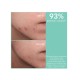 Apivita Just Bee Clear Ενυδατική Κρέμα Προσώπου Ημέρας 40ml