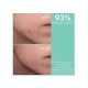 Apivita Lotion κατά της Ακμής Just Bee Clear για Λιπαρές Επιδερμίδες 200ml Apivita Lotion κατά της Ακμής Just Bee Clear για Λιπαρές Επιδερμίδες 200ml