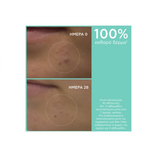 Apivita Gel Καθαρισμού Just Bee Clear για Λιπαρές Επιδερμίδες 200ml Apivita Gel Καθαρισμού Just Bee Clear για Λιπαρές Επιδερμίδες 200ml