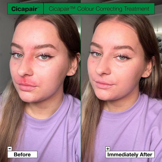 Dr. Jart+ Cicapair Tiger Grass Κρέμα Προσώπου Ημέρας με Χρώμα για Ευαίσθητες Επιδερμίδες 30ml Dr. Jart+ Cicapair Tiger Grass Κρέμα Προσώπου Ημέρας με Χρώμα για Ευαίσθητες Επιδερμίδες 30ml