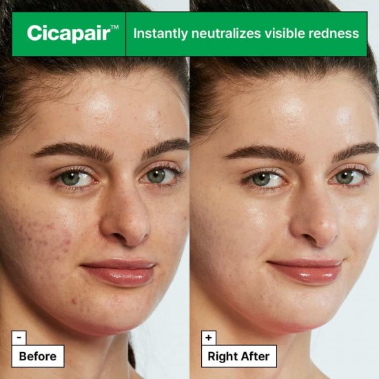 Dr. Jart+ Cicapair Tiger Grass Κρέμα Προσώπου Ημέρας με Χρώμα για Ευαίσθητες Επιδερμίδες 30ml Dr. Jart+ Cicapair Tiger Grass Κρέμα Προσώπου Ημέρας με Χρώμα για Ευαίσθητες Επιδερμίδες 30ml