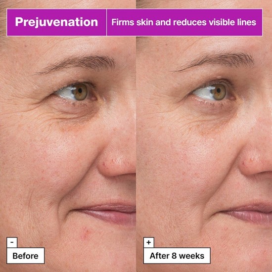Dr. Jart+ Prejuvenation Bakuchiol Αντιγηραντικό Serum Προσώπου για Σύσφιξη 50ml Dr. Jart+ Prejuvenation Bakuchiol Αντιγηραντικό Serum Προσώπου για Σύσφιξη 50ml