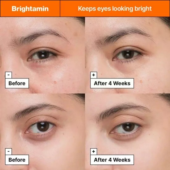 Dr. Jart+ Brightamin Stick Καταπραϋντικό & Αντιγηραντικό Serum Ματιών με Βιταμίνη C & Βιταμίνη E για Μαύρους Κύκλους & Λάμψη