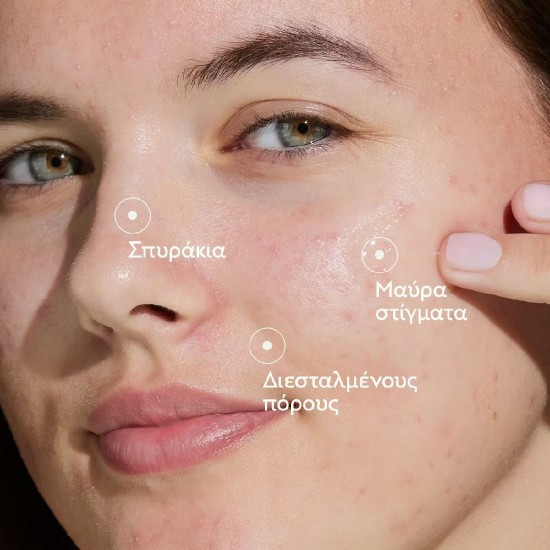 Caudalie Vinopure Blemish Control Serum Προσώπου με τάση ακμής 30ml