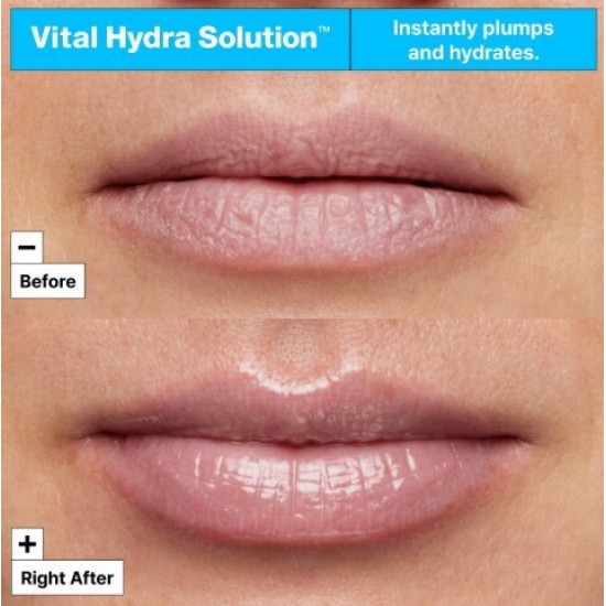Dr. Jart+ Vital Hydra Solution Jelly Lip Mask Μάσκα Χειλιών με Υαλουρονικό Οξύ 20ml
